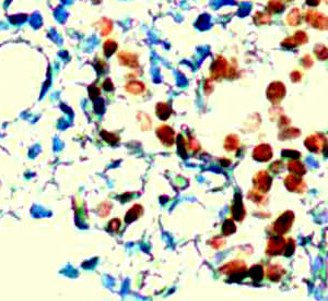 Androgen Receptor (AR) Antibody in Immunohistochemistry (Paraffin) (IHC (P))