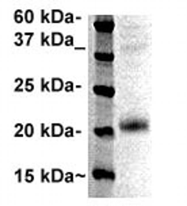 Casein (kappa) Antibody in Western Blot (WB)