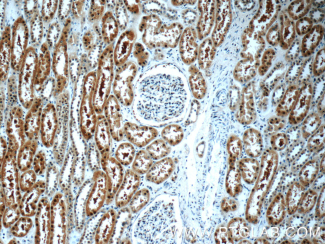 GAPDH Antibody in Immunohistochemistry (Paraffin) (IHC (P))