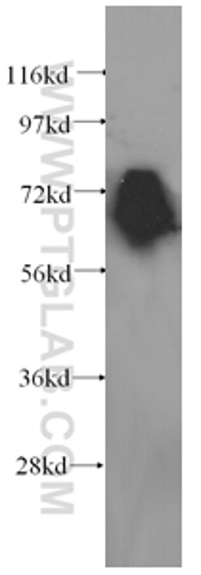 KEAP1 Antibody in Western Blot (WB)