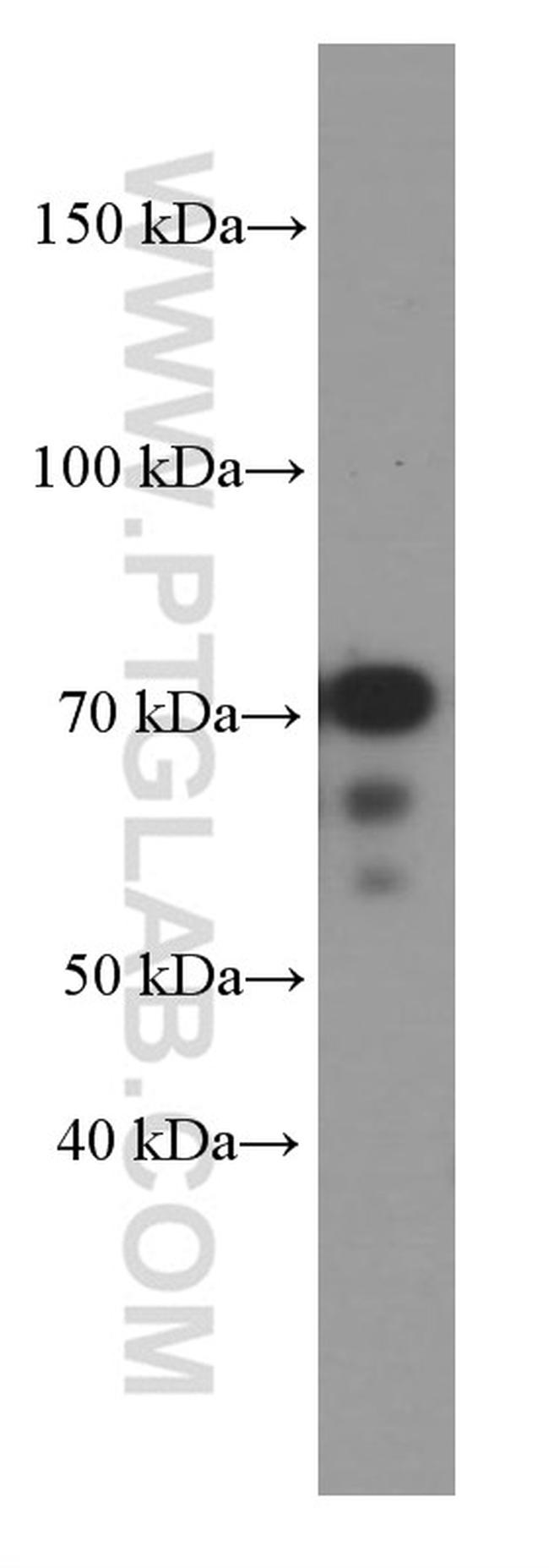 KEAP1 Antibody in Western Blot (WB)