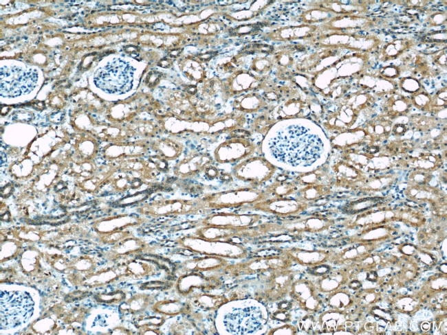 KEAP1 Antibody in Immunohistochemistry (Paraffin) (IHC (P))