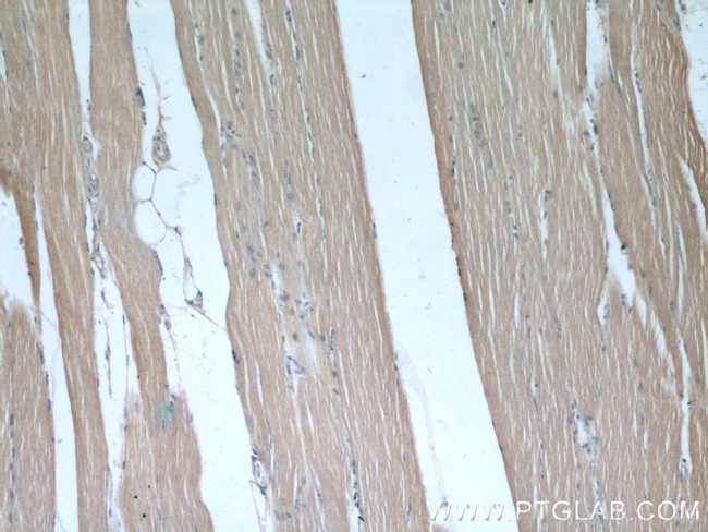 KEAP1 Antibody in Immunohistochemistry (Paraffin) (IHC (P))