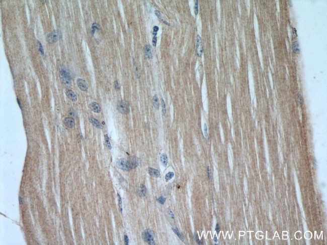 KEAP1 Antibody in Immunohistochemistry (Paraffin) (IHC (P))