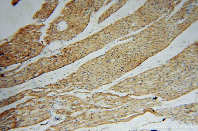 KMO Antibody in Immunohistochemistry (Paraffin) (IHC (P))