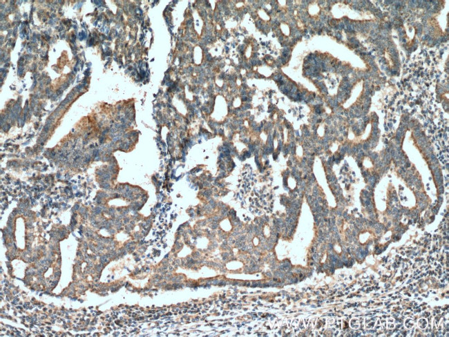 STOML2 Antibody in Immunohistochemistry (Paraffin) (IHC (P))