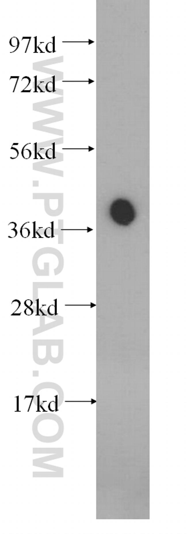 STOML2 Antibody in Western Blot (WB)