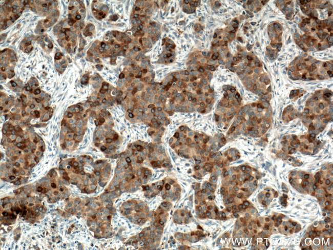 RRM1 Antibody in Immunohistochemistry (Paraffin) (IHC (P))