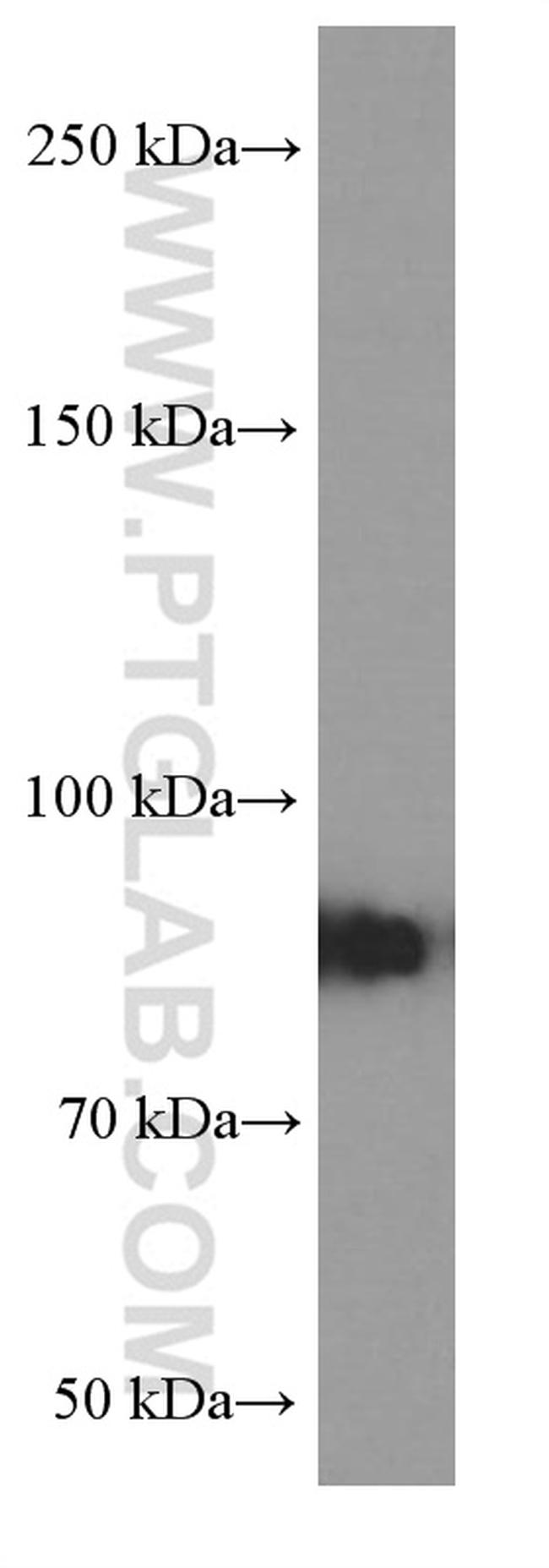 RRM1 Antibody in Western Blot (WB)