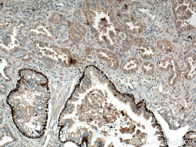 RRM1 Antibody in Immunohistochemistry (Paraffin) (IHC (P))