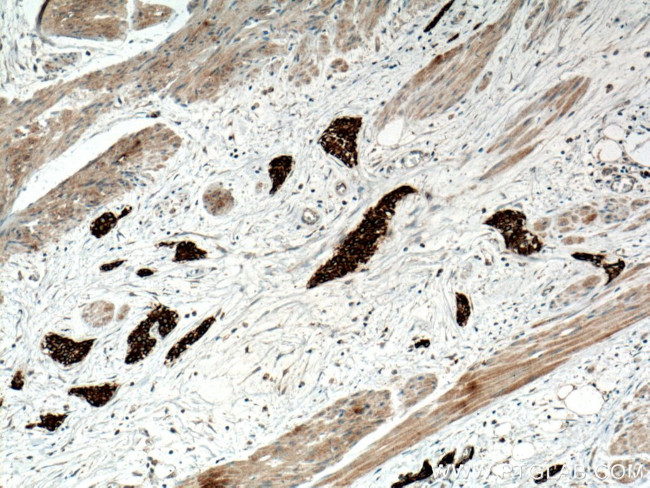 RRM1 Antibody in Immunohistochemistry (Paraffin) (IHC (P))