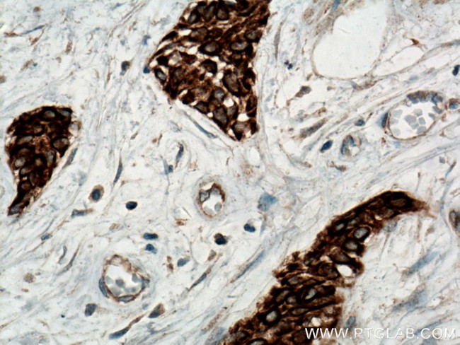 RRM1 Antibody in Immunohistochemistry (Paraffin) (IHC (P))