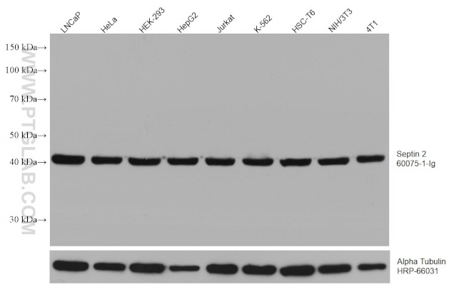 SEPT2 Antibody in Western Blot (WB)