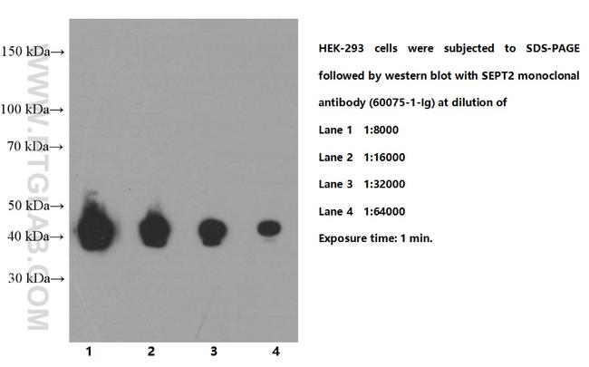 SEPT2 Antibody in Western Blot (WB)