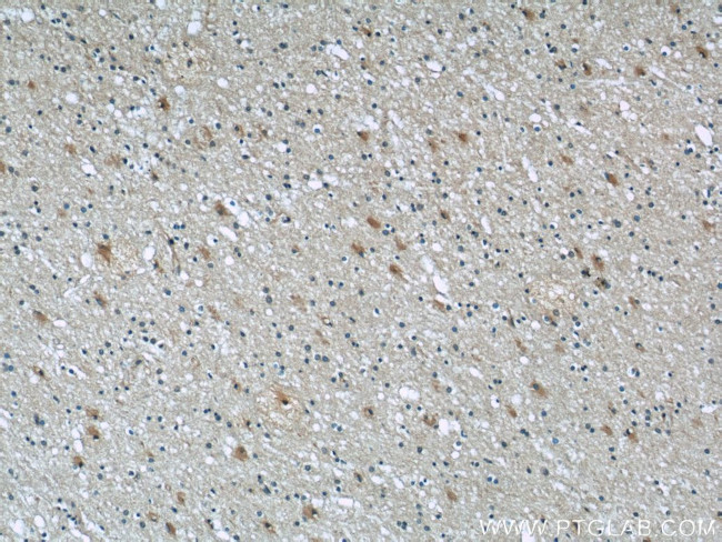 SEPT2 Antibody in Immunohistochemistry (Paraffin) (IHC (P))