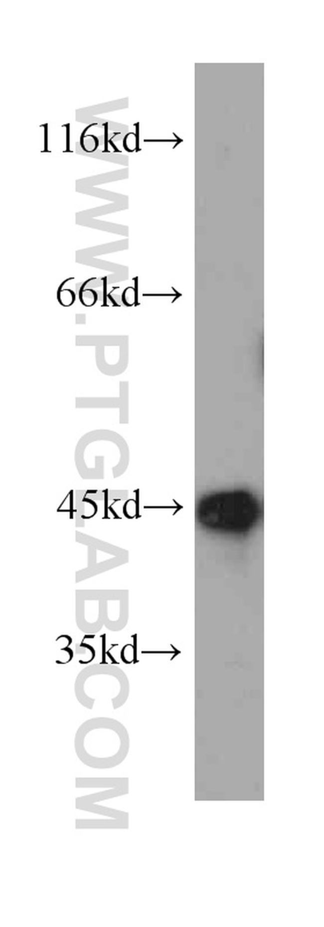 SEPT2 Antibody in Western Blot (WB)