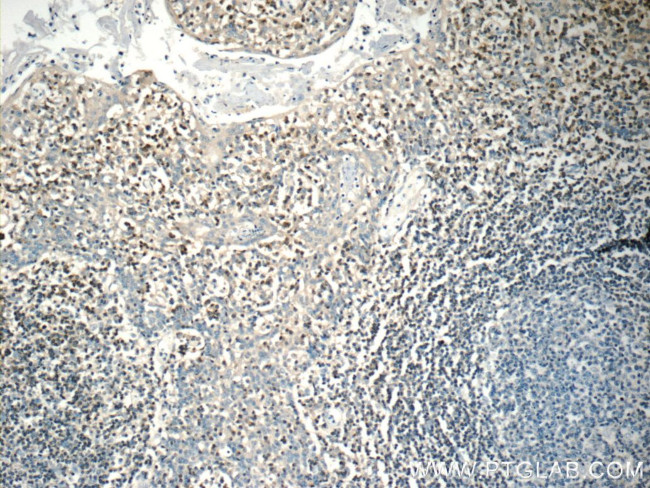 RAC2 Antibody in Immunohistochemistry (Paraffin) (IHC (P))