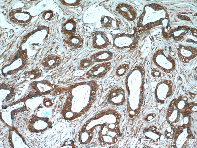 GDI2 Antibody in Immunohistochemistry (Paraffin) (IHC (P))