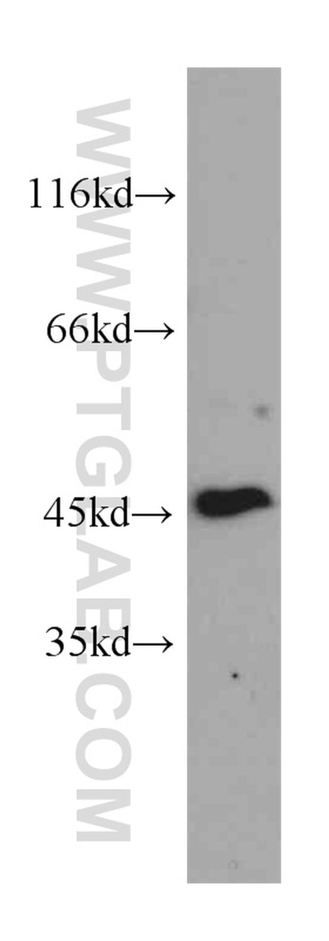 GDI2 Antibody in Western Blot (WB)