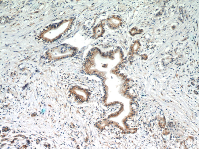 EEF1D Antibody in Immunohistochemistry (Paraffin) (IHC (P))