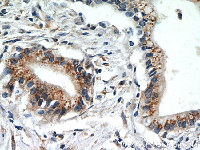 EEF1D Antibody in Immunohistochemistry (Paraffin) (IHC (P))