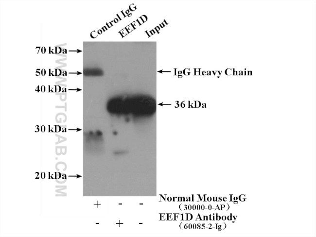 EEF1D Antibody in Immunoprecipitation (IP)