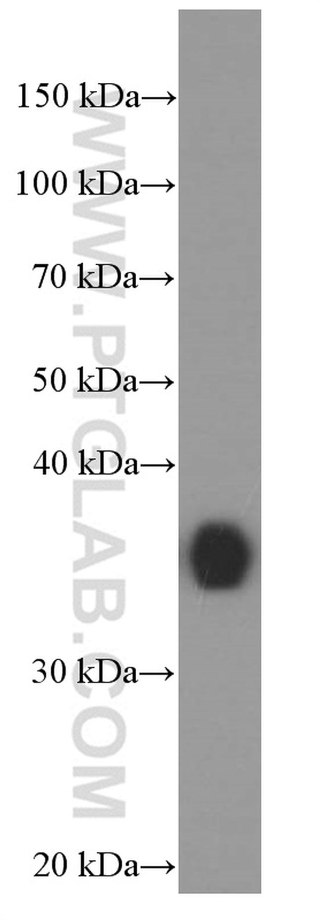 EEF1D Antibody in Western Blot (WB)