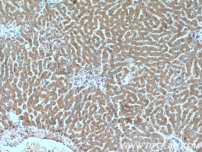 Prohibitin Antibody in Immunohistochemistry (Paraffin) (IHC (P))