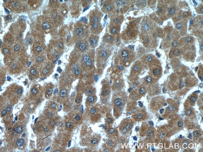 Prohibitin Antibody in Immunohistochemistry (Paraffin) (IHC (P))