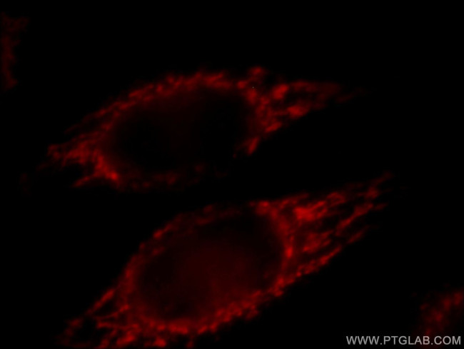 Prohibitin Antibody in Immunocytochemistry (ICC/IF)