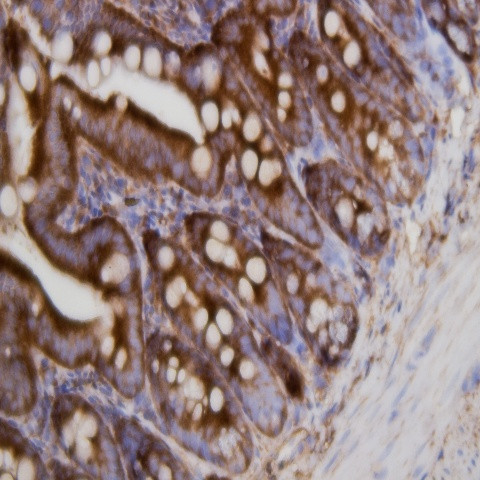 PCSK9 Antibody in Immunohistochemistry (Paraffin) (IHC (P))