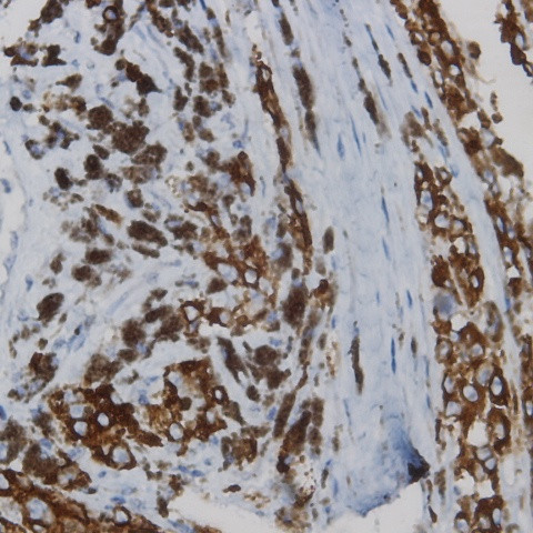 Phospho-CD136 (RON) (Tyr1239) Antibody in Immunohistochemistry (Paraffin) (IHC (P))