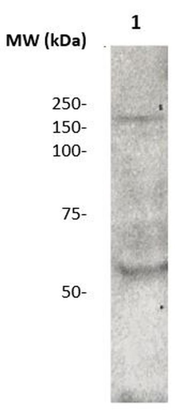 CD136 (RON) Antibody in Western Blot (WB)