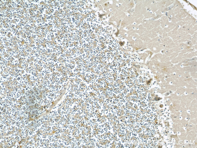 Neudesin/NENF Antibody in Immunohistochemistry (Paraffin) (IHC (P))