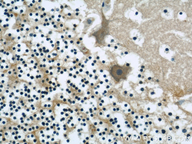 Neudesin/NENF Antibody in Immunohistochemistry (Paraffin) (IHC (P))