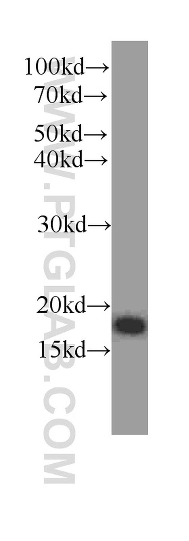 Neudesin/NENF Antibody in Western Blot (WB)