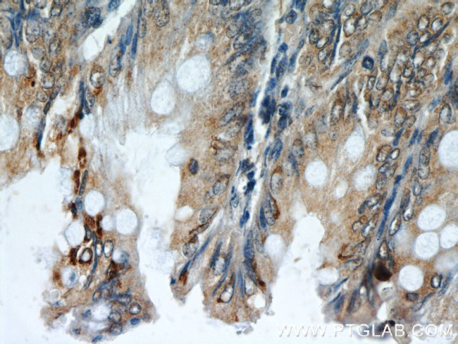 Neudesin/NENF Antibody in Immunohistochemistry (Paraffin) (IHC (P))