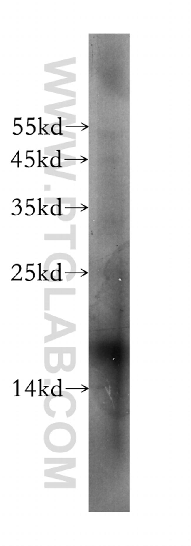 Neudesin/NENF Antibody in Western Blot (WB)