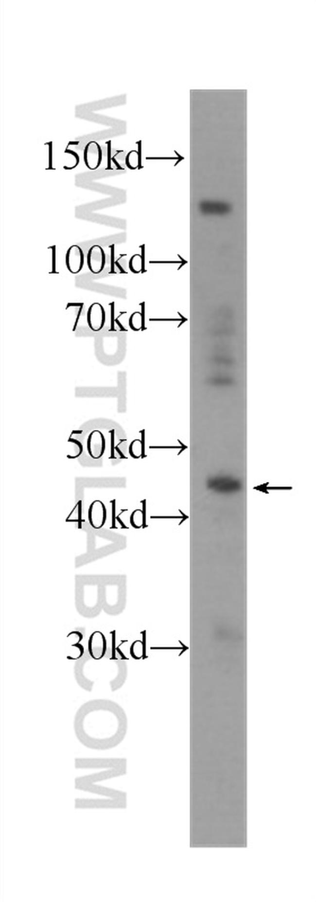 NR1H3 Antibody in Western Blot (WB)