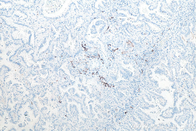 CD206 Antibody in Immunohistochemistry (Paraffin) (IHC (P))