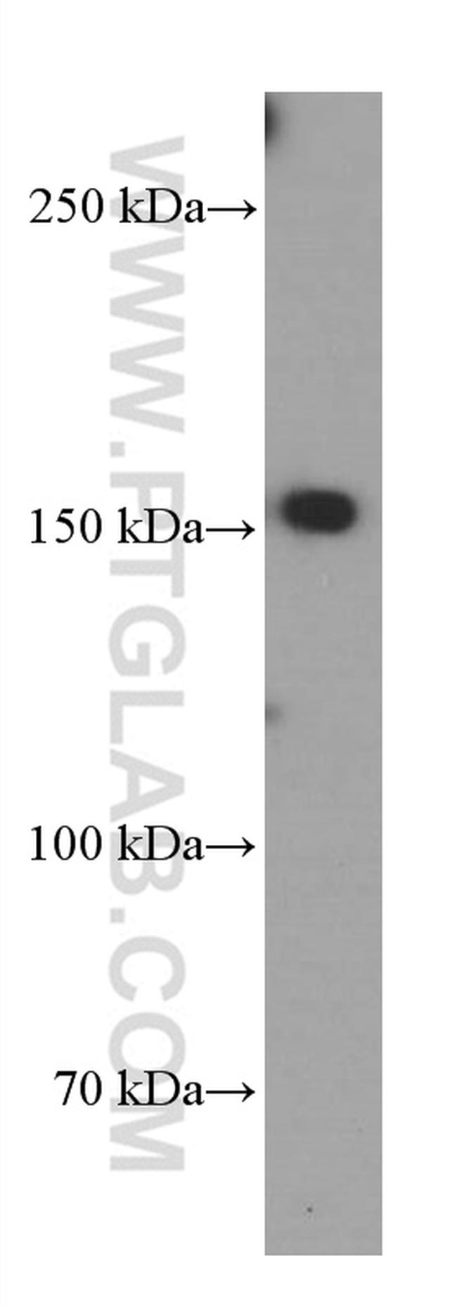 TEM1 Antibody in Western Blot (WB)