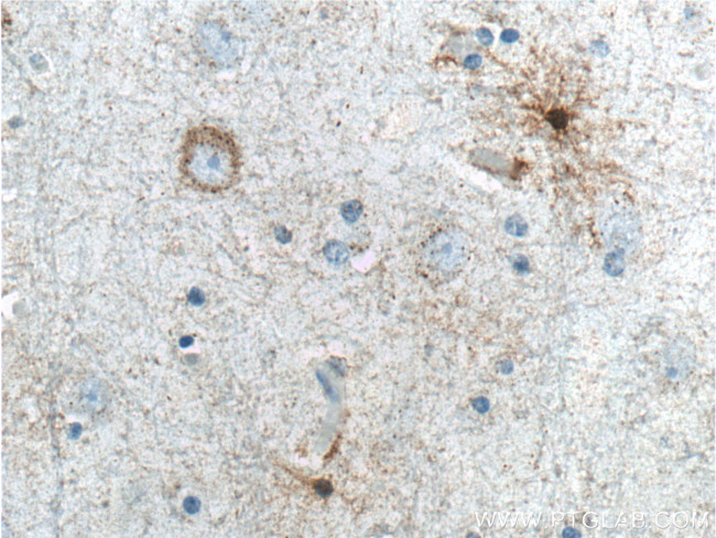 ALDH1A1 Antibody in Immunohistochemistry (Paraffin) (IHC (P))