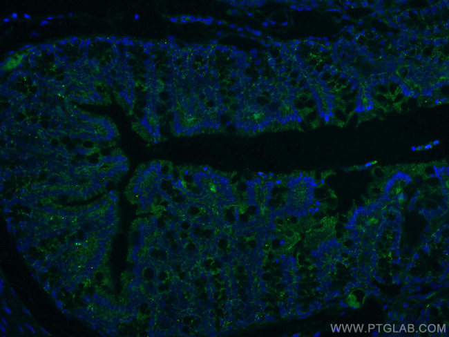 ALDH1A1 Antibody in Immunohistochemistry (PFA fixed) (IHC (PFA))