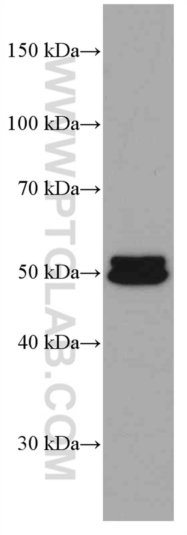 ALDH1A1 Antibody in Western Blot (WB)