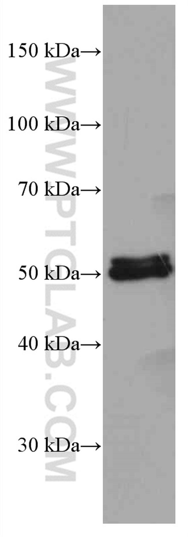 ALDH1A1 Antibody in Western Blot (WB)