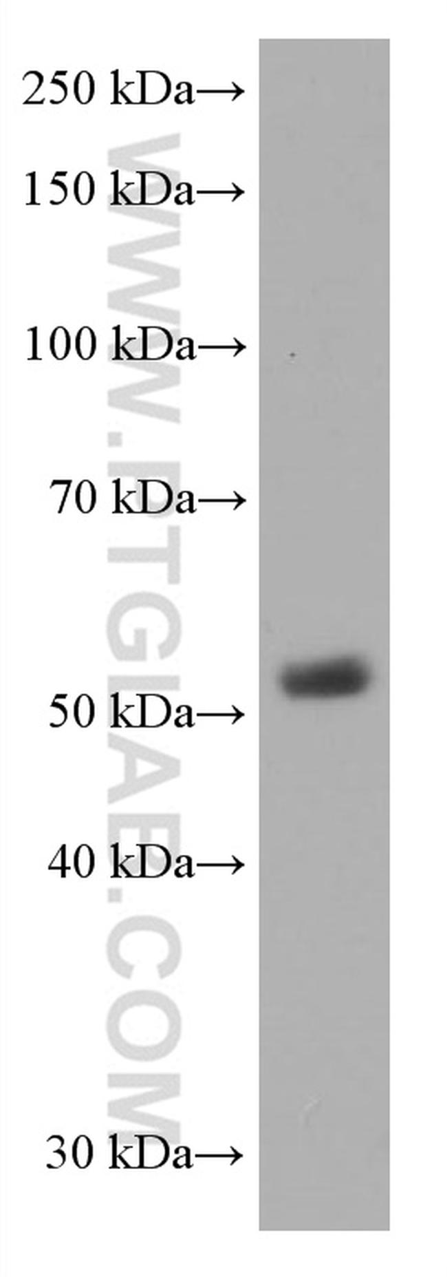 CD1A Antibody in Western Blot (WB)