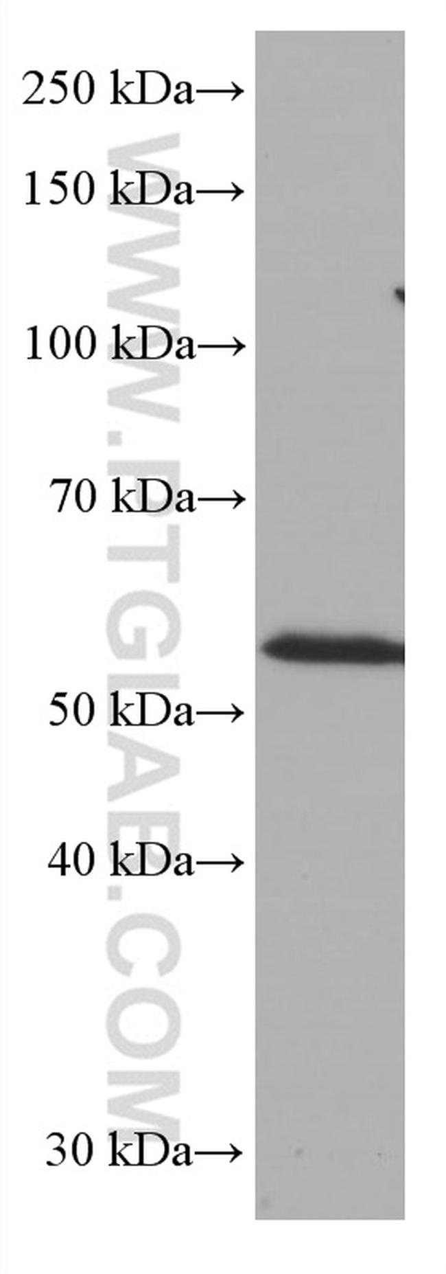 CD1A Antibody in Western Blot (WB)