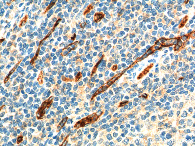 CD34 Antibody in Immunohistochemistry (Paraffin) (IHC (P))