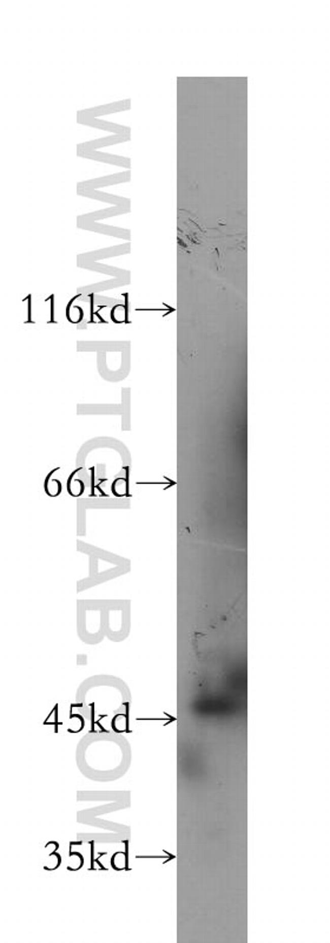 Cytokeratin 20 Antibody in Western Blot (WB)