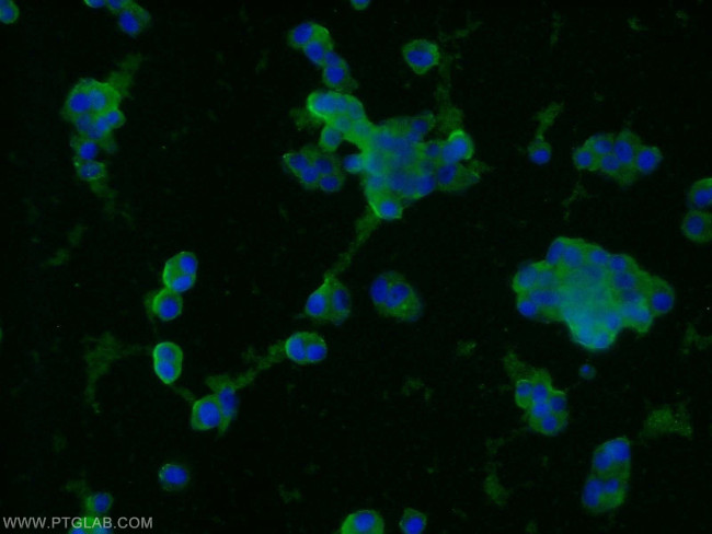 Synaptophysin Antibody in Immunocytochemistry (ICC/IF)